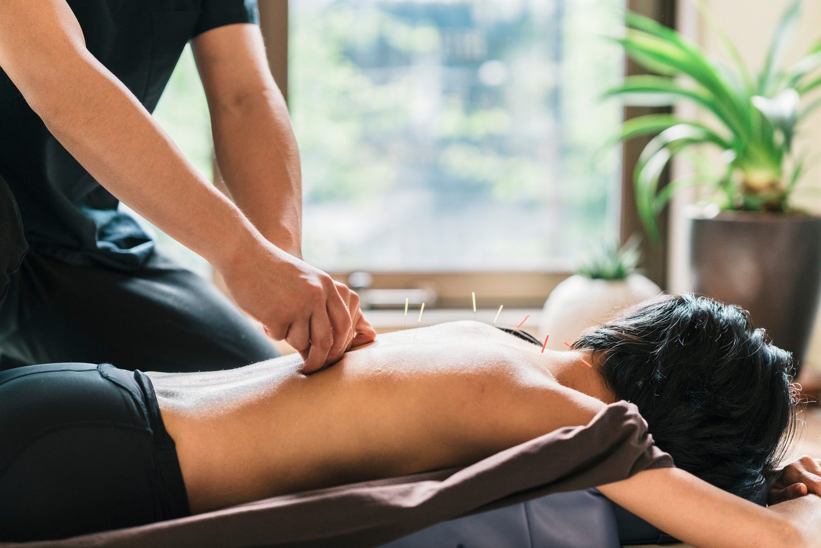 Acupuncturist gently placing needles along a patient's back during a relaxing treatment session